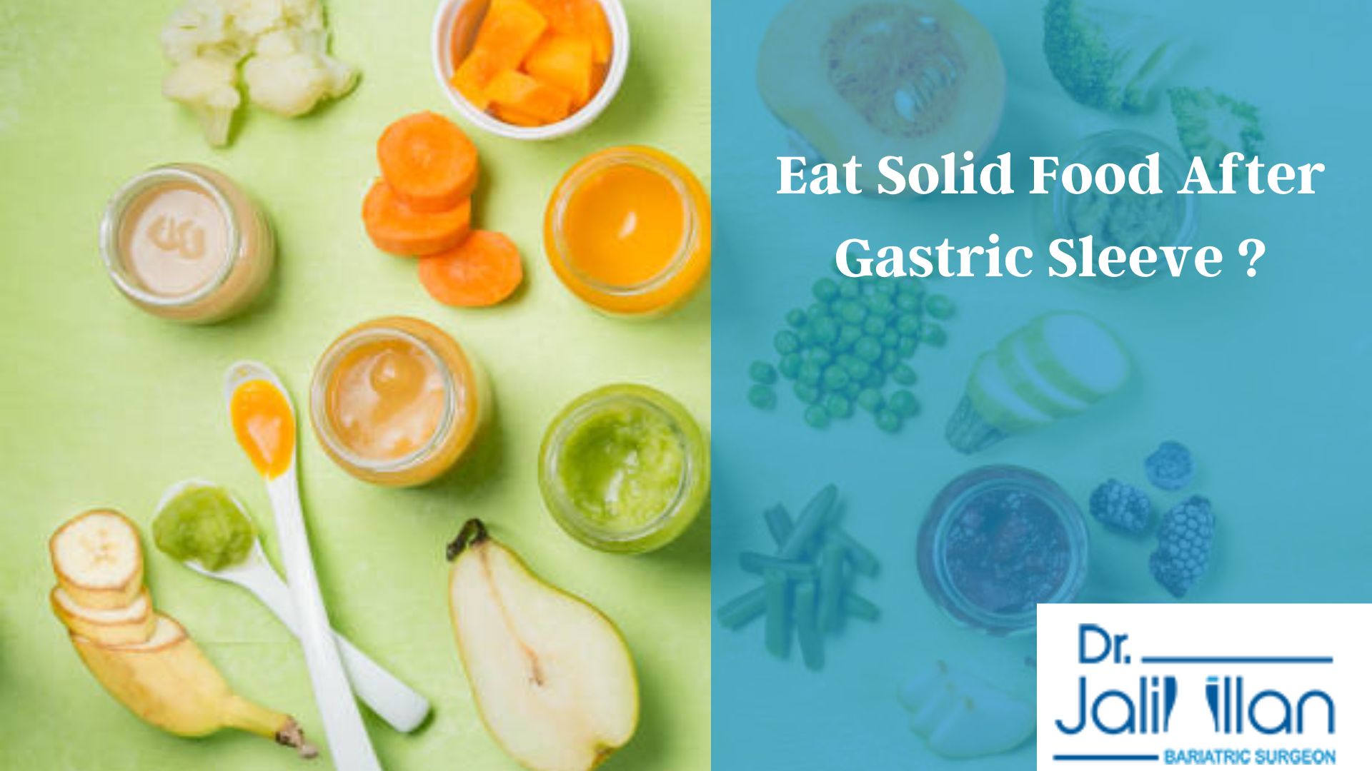 Solid food after gastric sleeve